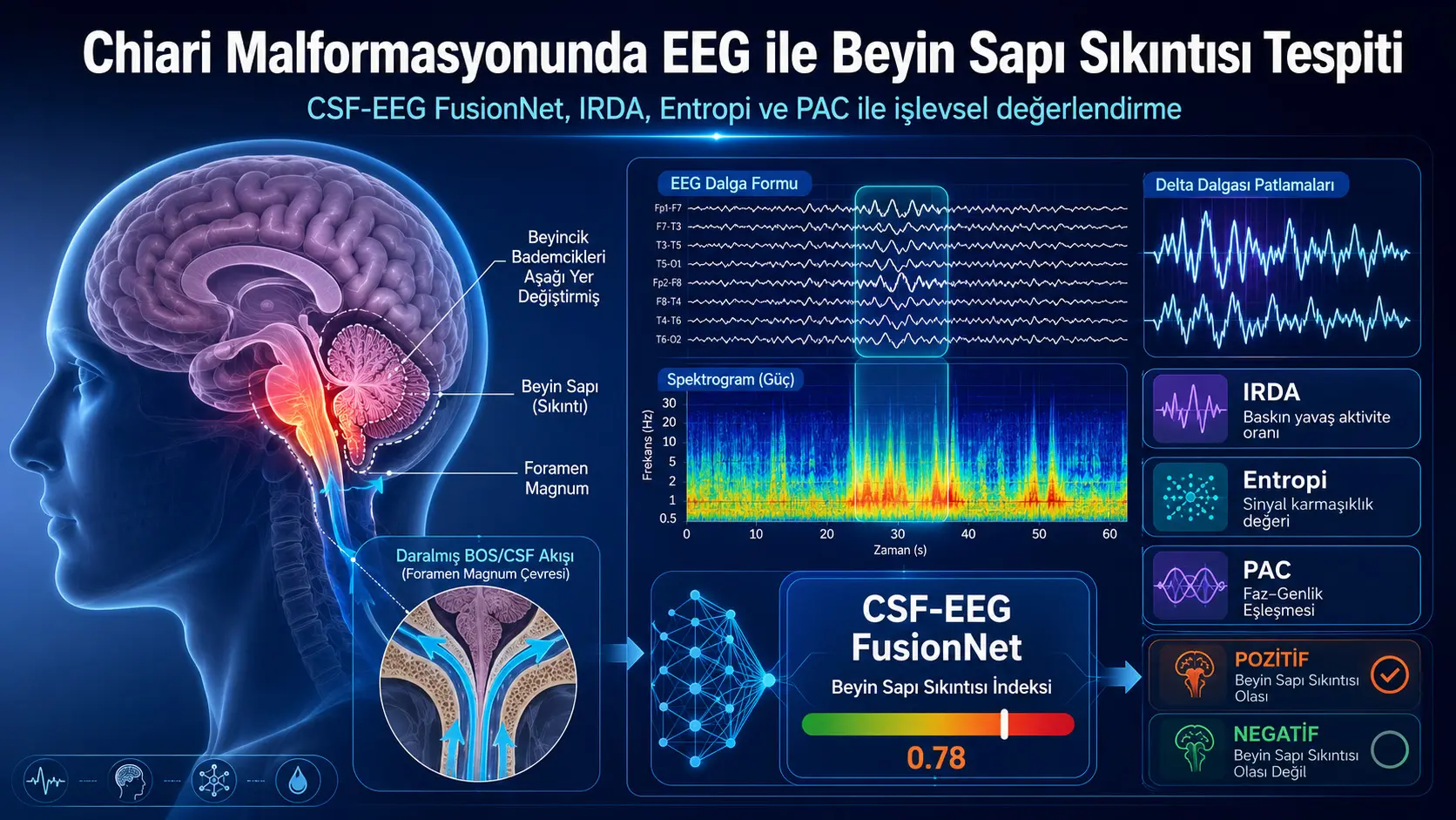 Chiari malformatsiyasida EEG orqali miya ustuni distressini aniqlash taklifi: CSF-EEG FusionNetning ikki yozuvdagi dastlabki sinovi