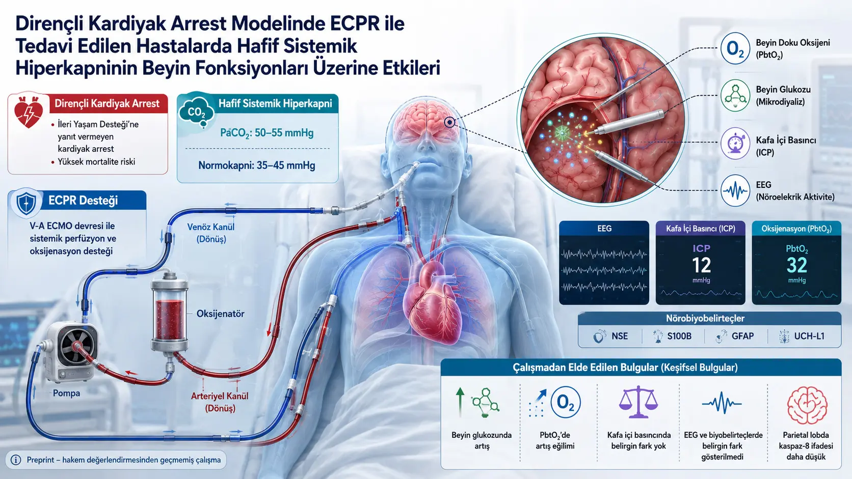 ECPR bilan davolangan refrakter yurak toʻxtashi modelida yengil tizimli giperkapniyaning miya faoliyatiga taʼsiri