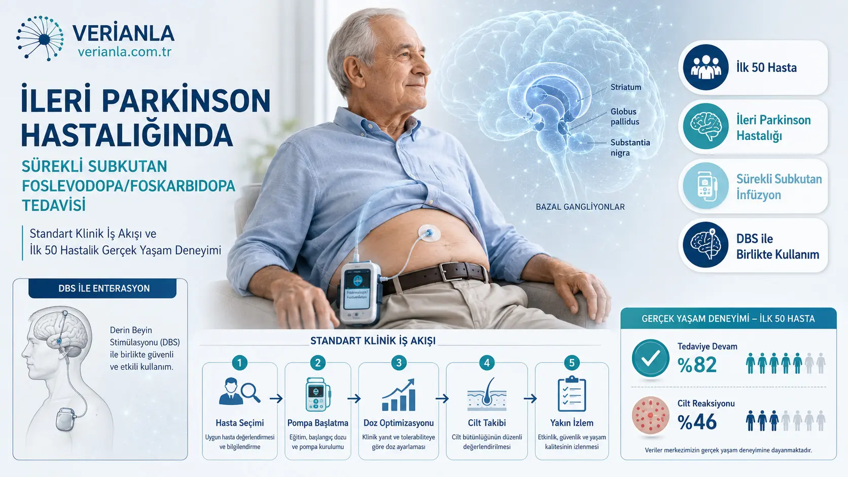 Ilg'or Parkinson Kasalligi Muammosida Doimiy Subkutan Foslevod'opa/Foskarbidog'opa Terapiyasi