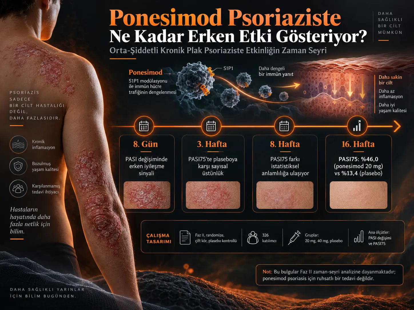 Ponesimod Kronik Plak Psoriaziste Ne Kadar Erken Etki Gösteriyor? Faz II Çalışmanın İlk 16 Haftalık Zaman Seyri