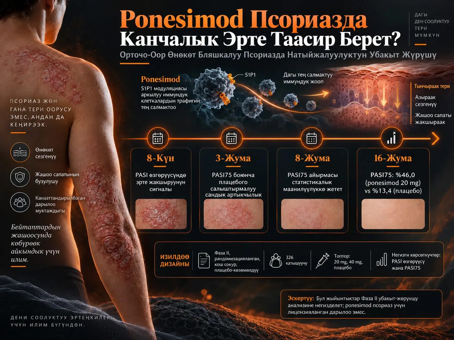 Ponesimod Өнөкөт Бляшкалуу Псориазда Канчалык Эрте Таасир Берет? Фаза II Изилдөөнүн Алгачкы 16 Жумалык Убакыт Жүрүшү