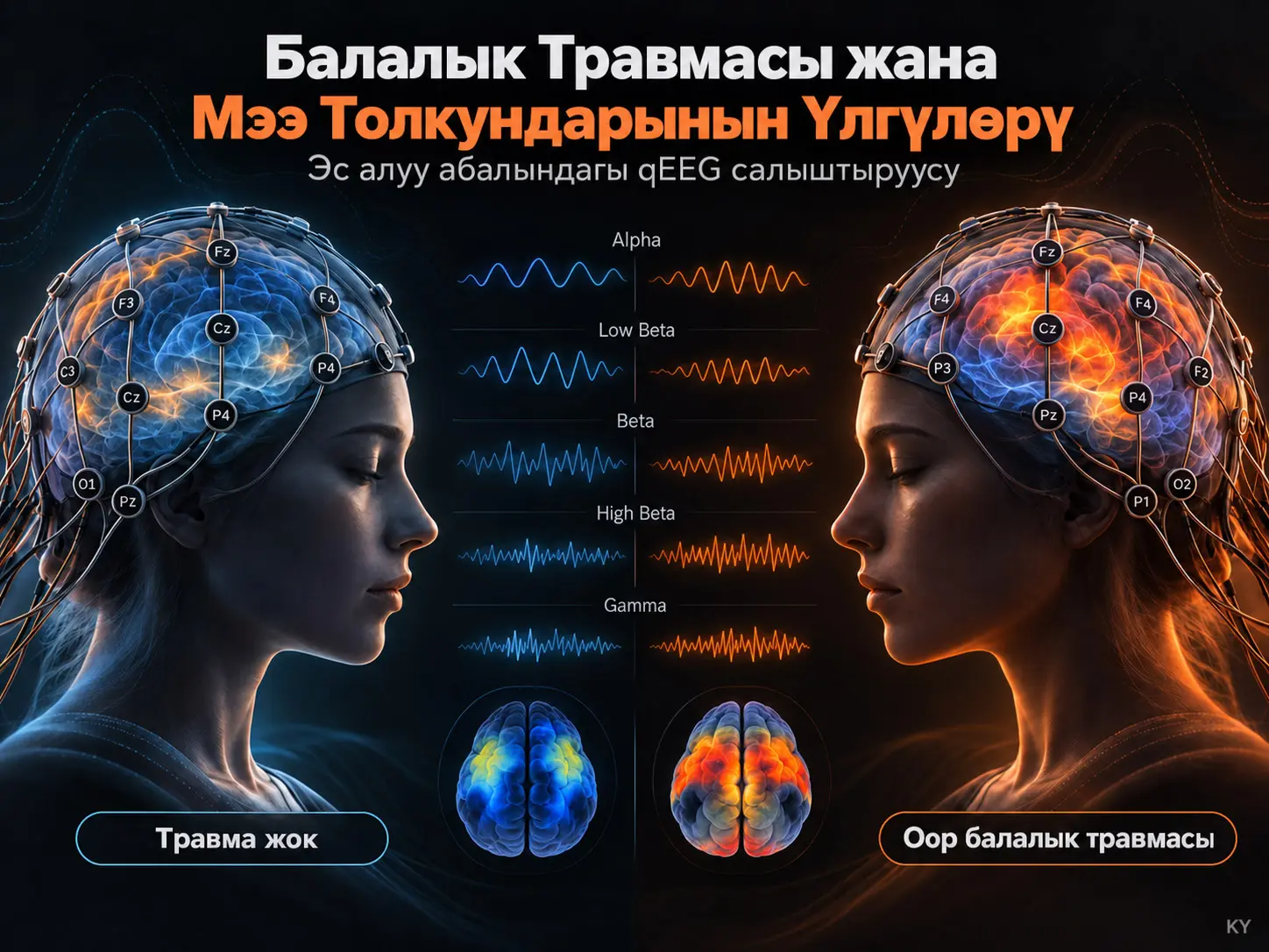 Балалык Травмасы жана Мээ Толкундарынын Үлгүлөрү: Травмадан Жабыркаган жана Жабыркабаган Адамдардын qEEG Салыштыруусу
