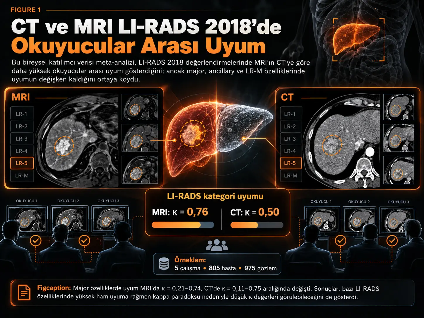 CT ve MRI LI-RADS 2018 Değerlendirmelerinde Radyologlar Ne Kadar Aynı Sonuca Ulaşıyor? Bireysel Katılımcı Verisi Meta-Analizi