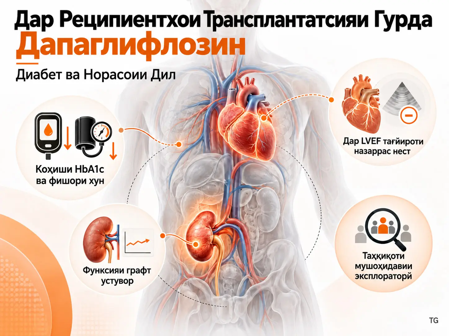 Дапаглифлозин ҳамчун Табобати Иловагӣ дар Реципиентҳои Трансплантатсияи Гурда бо Диабет ва Норасоии Дил: Таҳқиқоти Мушоҳидавии Эксплораторӣ