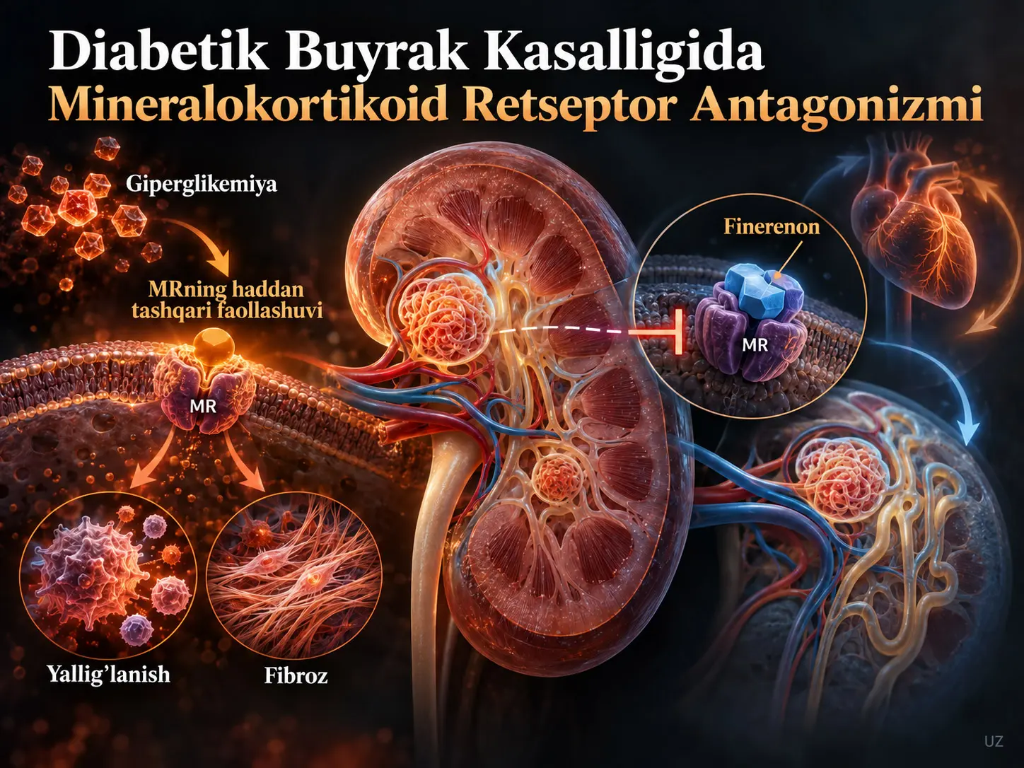 Diabetik Buyrak Kasalligida Mineralokortikoid Retseptor Antagonizmi: Patofiziologik Mexanizmlardan Klinik Paradigma Oʻzgarishlarigacha