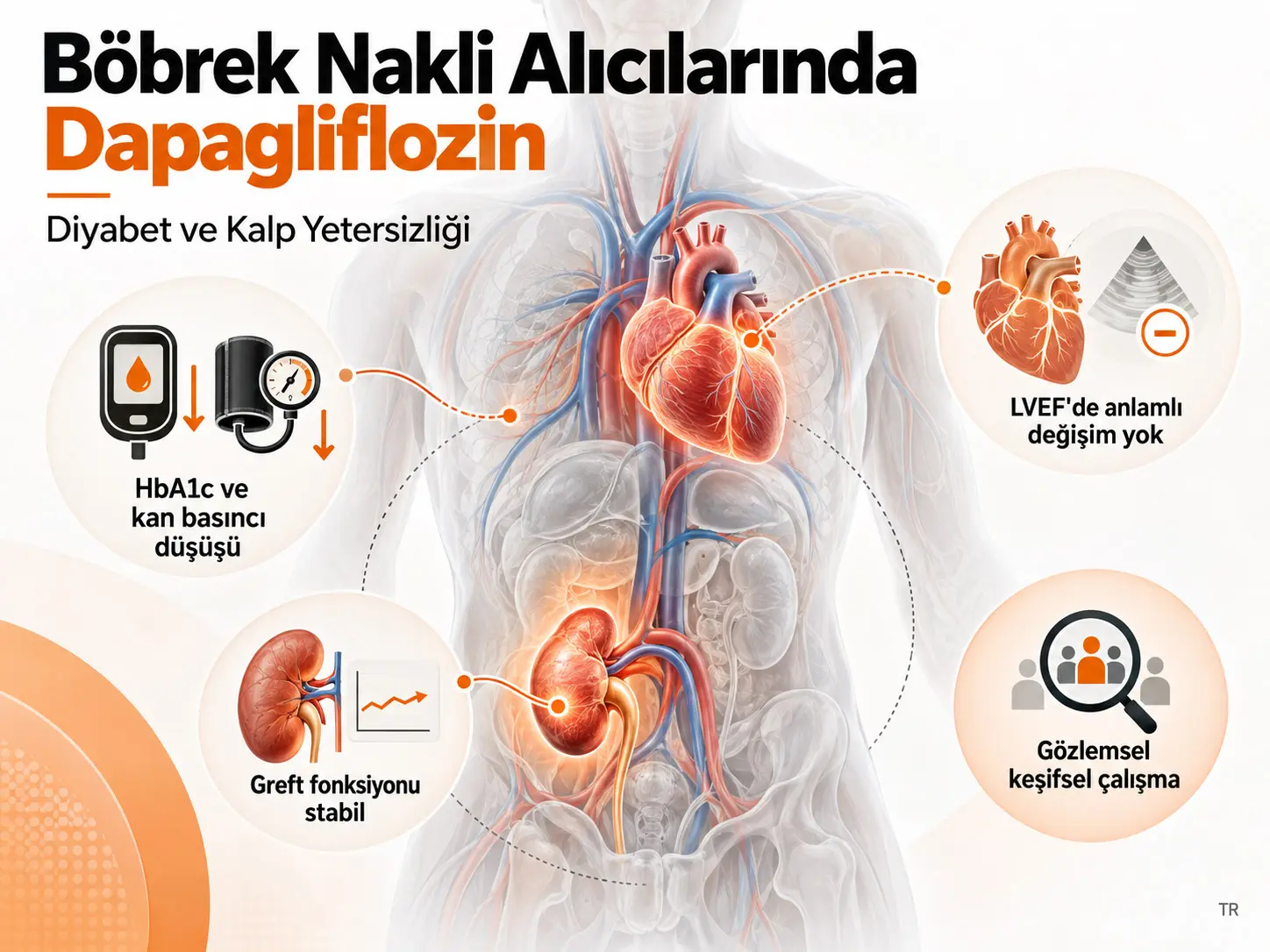Diyabet ve Kalp Yetersizliği Olan Böbrek Nakli Alıcılarında Ek Tedavi Olarak Dapagliflozin: Gözlemsel Keşifsel Bir Çalışma