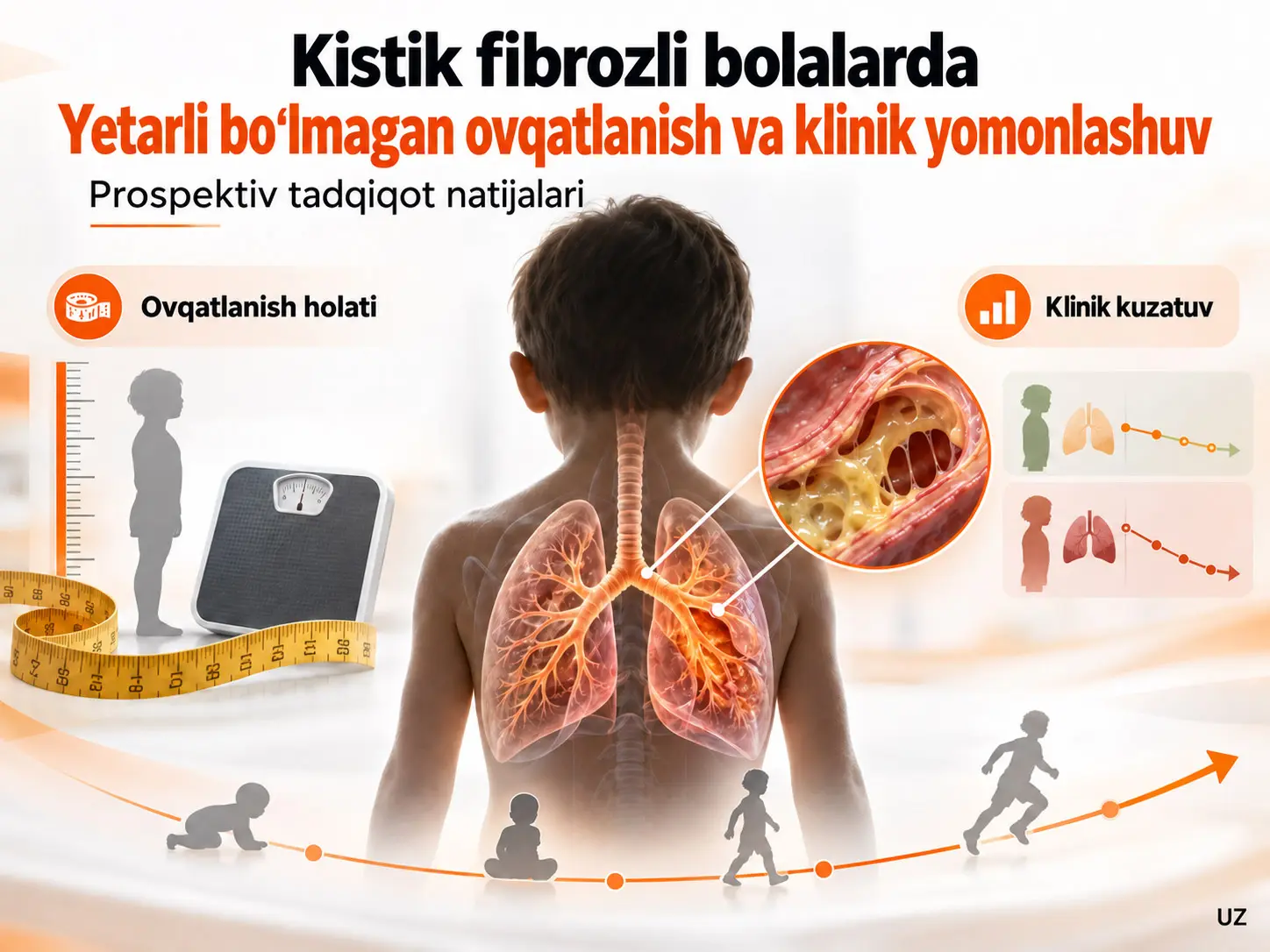 Kistik fibrozli bolalarda yetarli ovqatlanmaslik va klinik yomonlashuv: Prospektiv tadqiqot natijalari