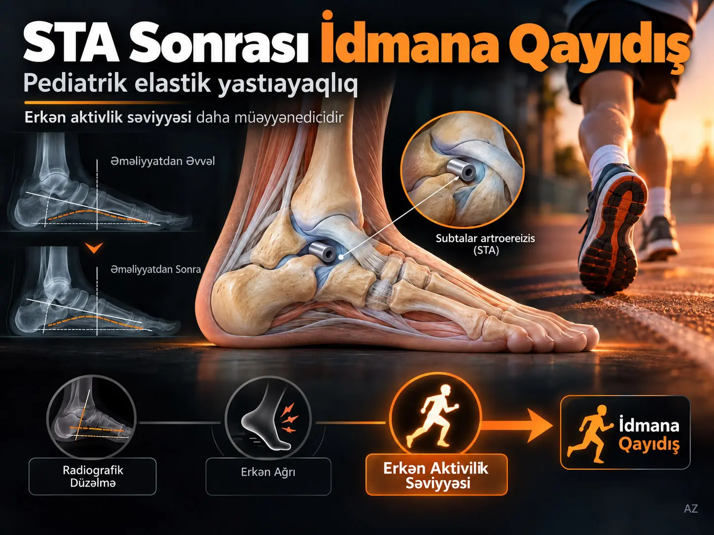 Pediatrik Elastik Yastıayaqlıqda Subtalar Artroerezisdən Sonra İdmana Qayıdış: Radiografik Düzəlmə və Qalıq Ağrı Müstəqil Proqnozlaşdırıcılar Deyil
