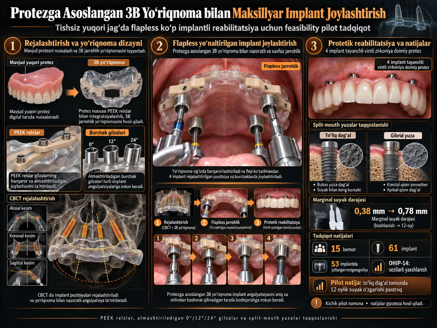 Tishsiz Yuqori Jag‘da Bir Nechta Implant Joylashtirish Uchun Protezga Asoslangan 3B Yo‘riqnoma Tizimi